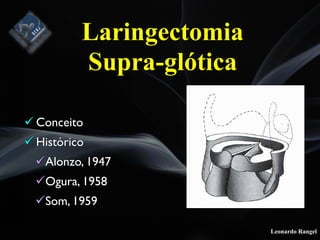 Leonardo Rangel
! Conceito
! Histórico
!Alonzo, 1947
!Ogura, 1958
!Som, 1959
Laringectomia
Supra-glótica
 