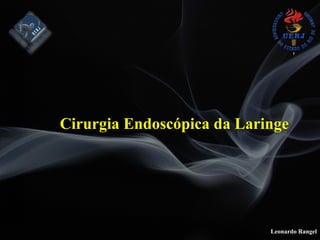 Leonardo Rangel
Cirurgia Endoscópica da Laringe
 