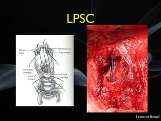 Leonardo Rangel
LPSC
 