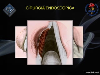 Leonardo Rangel
CIRURGIA ENDOSCÓPICA
 