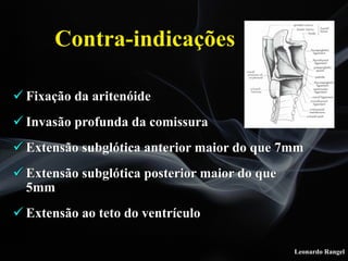 Leonardo Rangel
! Fixação da aritenóide
! Invasão profunda da comissura
! Extensão subglótica anterior maior do que 7mm
! Extensão subglótica posterior maior do que
5mm
! Extensão ao teto do ventrículo
Contra-indicações
 