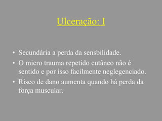 Ulceração: I
• Secundária a perda da sensbilidade.
• O micro trauma repetido cutâneo não é
sentido e por isso facilmente neglegenciado.
• Risco de dano aumenta quando há perda da
força muscular.
 