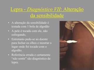 Lepra - Diagnóstico VII: Alteração
da sensibilidade
• A alteração da sensibilidade é
testada com 1 bola de algodão
• A pele é tocada com ele, não
esfregando,
• Entretanto pede-se ao doente
para fechar os olhos e mostrar o
lugar onde foi tocado com o
algodão.
• Referência errada e certamente
“não sentir” são diagnóstico de
lepra.
 