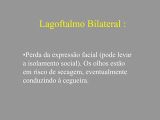 Lagoftalmo Bilateral :
•Perda da expressão facial (pode levar
a isolamento social). Os olhos estão
em risco de secagem, eventualmente
conduzindo à cegueira.
 