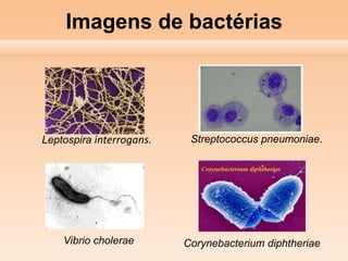 Imagens de bactérias

Leptospira interrogans.

Vibrio cholerae

Streptococcus pneumoniae.

Corynebacterium diphtheriae

 