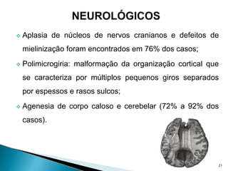  Aplasia de núcleos de nervos cranianos e defeitos de
mielinização foram encontrados em 76% dos casos;
 Polimicrogiria: malformação da organização cortical que
se caracteriza por múltiplos pequenos giros separados
por espessos e rasos sulcos;
 Agenesia de corpo caloso e cerebelar (72% a 92% dos
casos).
21
 