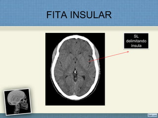 FITA INSULAR

                   SL
               delimitando
                 ínsula
 