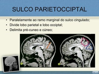 SULCO PARIETOCCIPTAL
• Paralelamente ao ramo marginal do sulco cingulado;
• Divide lobo parietal e lobo occiptal;
• Delimita pré-cuneo e cúneo;
 