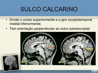 SULCO CALCARINO
• Divide o cúneo superiormente e o giro occiptotemporal
  medial inferiormente;
• Tem orientação perpendicular ao sulco parietocciptal;
 