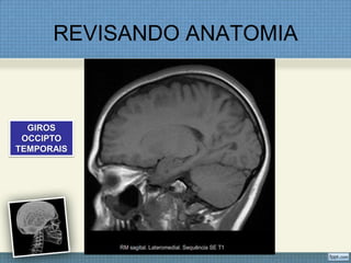 REVISANDO ANATOMIA



  GIROS
 OCCIPTO
TEMPORAIS
 