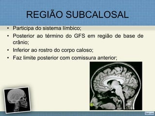 REGIÃO SUBCALOSAL
• Participa do sistema límbico;
• Posterior ao término do GFS em região de base de
  crânio;
• Inferior ao rostro do corpo caloso;
• Faz limite posterior com comissura anterior;
 
