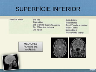 SUPERFÍCIE INFERIOR




  MELHORES
  PLANOS DE
   ANÁLISE:
 