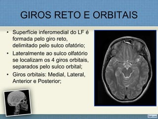 GIROS RETO E ORBITAIS
• Superfície inferomedial do LF é
  formada pelo giro reto,
  delimitado pelo sulco ofatório;
• Lateralmente ao sulco olfatório
  se localizam os 4 giros orbitais,
  separados pelo sulco orbital;
• Giros orbitais: Medial, Lateral,
  Anterior e Posterior;
 