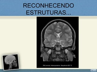 RECONHECENDO
 ESTRUTURAS...
 