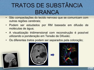 TRATOS DE SUBSTÂNCIA
          BRANCA
• São compactações do tecido nervoso que se comunicam com
  outras regiões cerebrais;
• Podem ser estudados por RM baseada em difusão de
  moléculas de água;
• A visualização tridimensional com reconstrução é possível
  utilizando a ponderação em Tensão de Difusão;
• Os diferentes tratos podem ser separados pela coloração;
 
