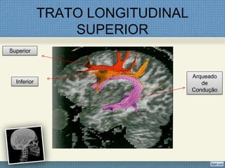 TRATO LONGITUDINAL
                 SUPERIOR
Superior



                                  Arqueado
  Inferior                           de
                                  Condução
 
