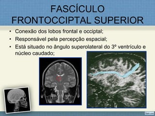 FASCÍCULO
FRONTOCCIPTAL SUPERIOR
• Conexão dos lobos frontal e occiptal;
• Responsável pela percepção espacial;
• Está situado no ângulo superolateral do 3º ventrículo e
  núcleo caudado;
 