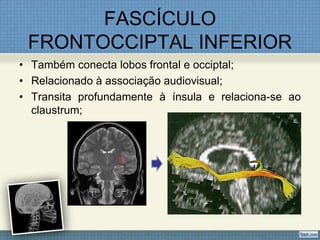 FASCÍCULO
 FRONTOCCIPTAL INFERIOR
• Também conecta lobos frontal e occiptal;
• Relacionado à associação audiovisual;
• Transita profundamente à ínsula e relaciona-se ao
  claustrum;
 