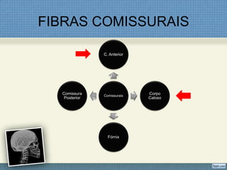 FIBRAS COMISSURAIS

               C. Anterior




  Comissura    Comissurais
                             Corpo
   Posterior                 Caloso




                 Fórnix
 