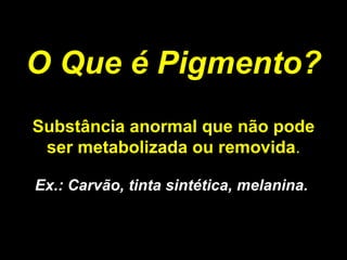 O Que é Pigmento? Substância anormal que não pode ser   metabolizada ou removida . Ex.: Carvão, tinta sintética, melanina.  
