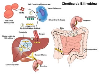 Cinética da Bilirrubina Hemáceas Senescentes HEME BILIVERDINA COMPLEXO BILIRRUBINA-ALBUMINA Cél. Fagocítica Mononuclear Heme Oxigenase Biliverdina Redutase Hepatócito Glucuronídio de Bilirrubina Canalículo Biliar Sangue Ductos Biliares Duodeno Duodeno Cólon Urobilinogênio 