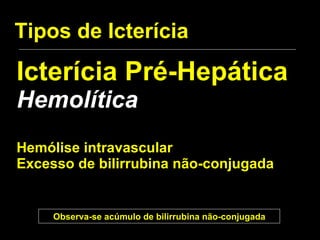 Tipos de Icterícia Icterícia Pré-Hepática Hemolítica Hemólise intravascular Excesso de bilirrubina não-conjugada Observa-se acúmulo de bilirrubina não-conjugada 
