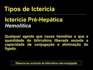 Tipos de Icterícia Icterícia Pré-Hepática Hemolítica Qualquer agente que cause hemólise e que a quantidade de bilirrubina liberada exceda a capacidade de conjugação e eliminação do fígado. Observa-se acúmulo de bilirrubina não-conjugada 