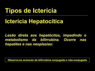 Tipos de Icterícia Icterícia Hepatocítica Lesão direta aos hepatócitos, impedindo o metabolismo da bilirrubina. Ocorre nas hepatites e nas neoplasias: Observa-se acúmulo de bilirrubina conjugada e não-conjugada 