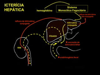 hemoglobina Sistema Monocítico Fagocitário bilirrubina conjugada FÍGADO RIM ICTERÍCIA HEPÁTICA    excreção de bilirrubina biliar refluxo de bilirrubina não-conjugada refluxo de bilirrubina conjugada  urobilinogênio fecal 