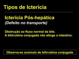 Tipos de Icterícia Icterícia Pós-hepática (Defeito no transporte) Obstrução ao fluxo normal da bile.  A bilirrubina conjugada não atinge o intestino. Observa-se acúmulo de bilirrubina conjugada 
