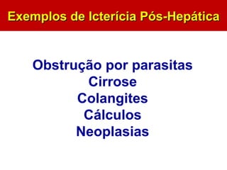 Exemplos de Icterícia Pós-Hepática Obstrução por parasitas Cirrose Colangites Cálculos Neoplasias 