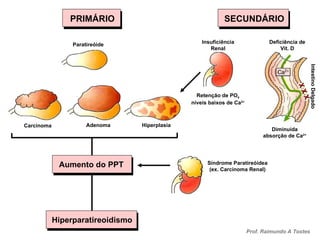 PRIMÁRIO SECUNDÁRIO Hiperparatireoidismo Aumento do PPT Paratireóide Insuficiência Renal Retenção de PO 4  níveis baixos de Ca 2+ Deficiência de Vit. D Intestino Delgado Diminuída absorção de Ca 2+ Síndrome Paratireóidea (ex. Carcinoma Renal) Carcinoma Adenoma Hiperplasia Prof. Raimundo A Tostes 