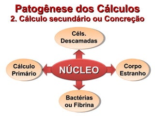 Patogênese dos Cálculos 2. Cálculo secundário ou Concreção NÚCLEO Céls. Descamadas Bactérias ou Fibrina Cálculo Primário Corpo Estranho 