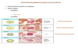 LEUCÓCITOS POLIMORFONUCLEARES OU GRANULÓCITOSLEUCÓCITOS POLIMORFONUCLEARES OU GRANULÓCITOS
• Possuem inúmeros grânulos no citoplasma
• Núcleo irregular
– Neutrófilos
• Menor que o macrófago, não presente em tecidos saudáveis
• Fagocitose
– Eosinófilos
a contra parasitas e vermes
– Mastócitos/Basófilos
• Alergias
Núcleo bilobado/reniforme
Núcleo multilobulado
Núcleo em forma de ferradura
 
