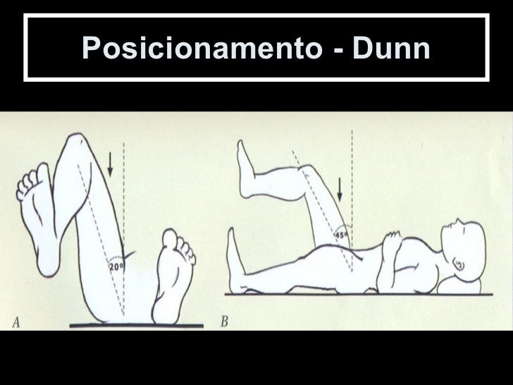Aula sobre quadril, série para sindrome do impacto femoro acetabular
