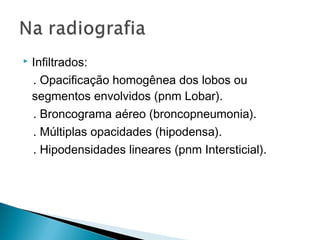    Infiltrados:
    . Opacificação homogênea dos lobos ou
    segmentos envolvidos (pnm Lobar).
    . Broncograma aéreo (broncopneumonia).
    . Múltiplas opacidades (hipodensa).
    . Hipodensidades lineares (pnm Intersticial).
 