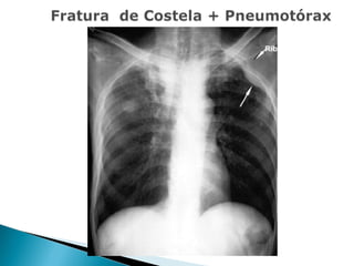 Aula de Radiologia
