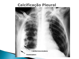 Aula de Radiologia