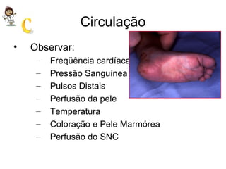 Circulação Observar: Freqüência cardíaca Pressão Sanguínea Pulsos Distais Perfusão da pele Temperatura Coloração e Pele Marmórea Perfusão do SNC 