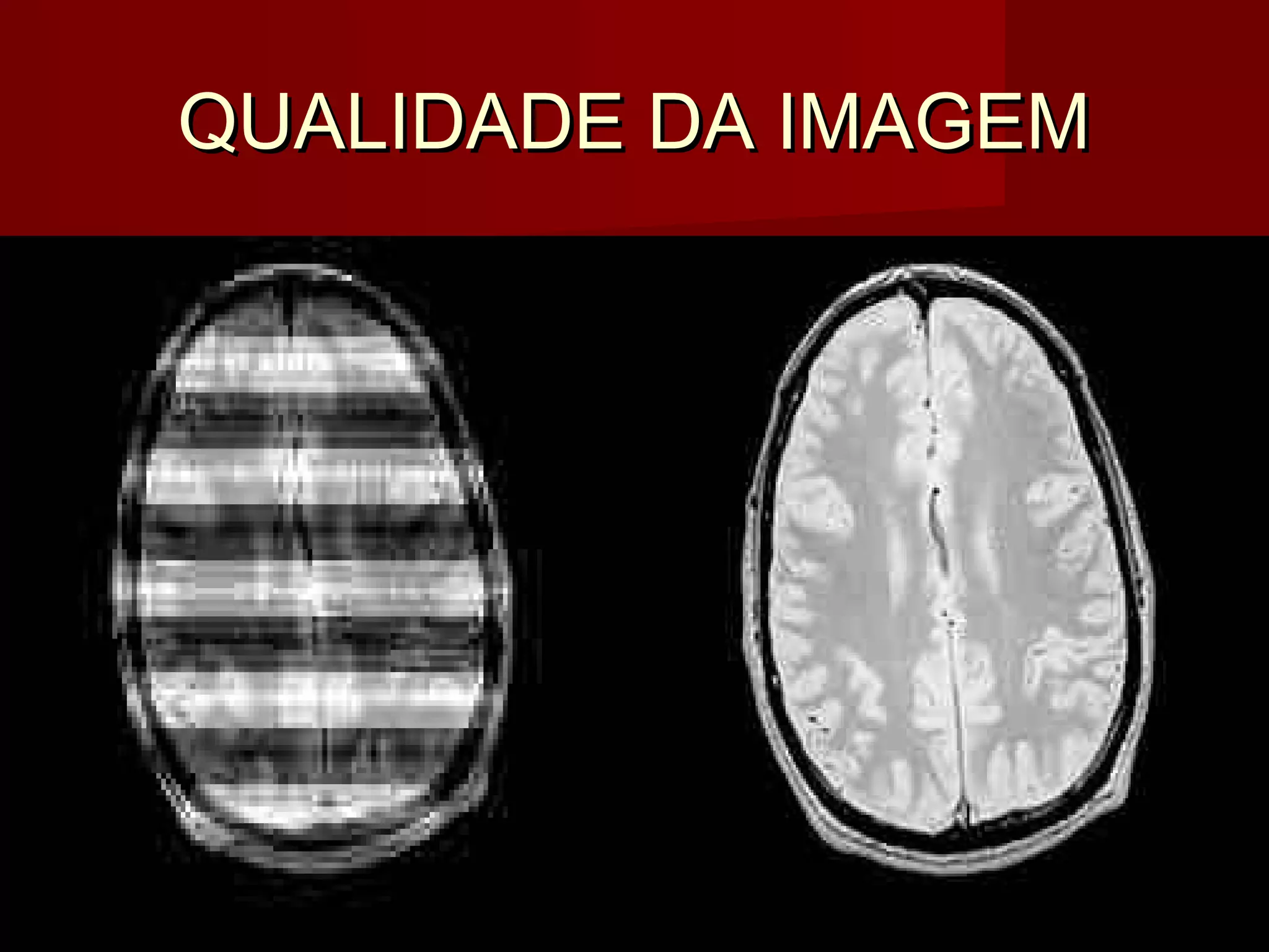 QUALIDADE DA IMAGEMQUALIDADE DA IMAGEM
 