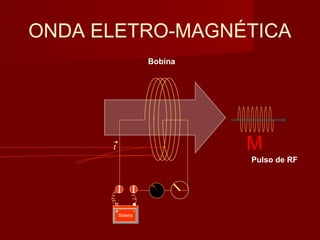 ONDA ELETRO-MAGNÉTICA
Bobina
M
Bateria
+ -
ι
Pulso de RF
 