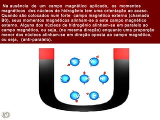 Na ausência de um campo magnético aplicado, os momentos
magnéticos dos núcleos de hidrogênio tem uma orientação ao acaso.
Quando são colocados num forte campo magnético externo (chamado
B0), seus momentos magnéticos alinham-se a este campo magnético
externo. Alguns dos núcleos de hidrogênio alinham-se em paralelo ao
campo magnético, ou seja, (na mesma direção) enquanto uma proporção
menor dos núcleos alinham-se em direção oposta ao campo magnético,
ou seja, (anti-paralelo).
 