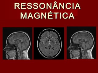 RESSONÂNCIARESSONÂNCIA
MAGNÉTICAMAGNÉTICA
 