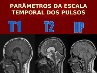 PARÂMETROS DA ESCALA
TEMPORAL DOS PULSOS
 