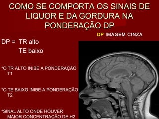 COMO SE COMPORTA OS SINAIS DECOMO SE COMPORTA OS SINAIS DE
LIQUOR E DA GORDURA NALIQUOR E DA GORDURA NA
PONDERAÇÃO DPPONDERAÇÃO DP
DP = TR alto
TE baixo
*O TR ALTO INIBE A PONDERAÇÃO
T1
*O TE BAIXO INIBE A PONDERAÇÃO
T2
*SINAL ALTO ONDE HOUVER
MAIOR CONCENTRAÇÃO DE H2
DP IMAGEM CINZA
 