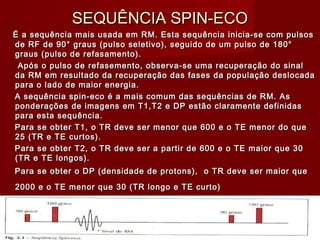 SEQUÊNCIA SPIN-ECOSEQUÊNCIA SPIN-ECO
É a sequência mais usada em RM. Esta sequência inicia-se com pulsosÉ a sequência mais usada em RM. Esta sequência inicia-se com pulsos
de RF de 90° graus (pulso seletivo), seguido de um pulso de 180°de RF de 90° graus (pulso seletivo), seguido de um pulso de 180°
graus (pulso de refasamento).graus (pulso de refasamento).
Após o pulso de refasemento, observa-se uma recuperação do sinalApós o pulso de refasemento, observa-se uma recuperação do sinal
da RM em resultado da recuperação das fases da população deslocadada RM em resultado da recuperação das fases da população deslocada
para o lado de maior energia.para o lado de maior energia.
A sequência spin-eco é a mais comum das sequências de RM. AsA sequência spin-eco é a mais comum das sequências de RM. As
ponderações de imagens em T1,T2 e DP estão claramente definidasponderações de imagens em T1,T2 e DP estão claramente definidas
para esta sequência.para esta sequência.
Para se obter T1, o TR deve ser menor que 600 e o TE menor do quePara se obter T1, o TR deve ser menor que 600 e o TE menor do que
25 (TR e TE curtos).25 (TR e TE curtos).
Para se obter T2, o TR deve ser a partir de 600 e o TE maior que 30Para se obter T2, o TR deve ser a partir de 600 e o TE maior que 30
(TR e TE longos).(TR e TE longos).
Para se obter o DP (densidade de protons), o TR deve ser maior quePara se obter o DP (densidade de protons), o TR deve ser maior que
2000 e o TE menor que 30 (TR longo e TE curto)2000 e o TE menor que 30 (TR longo e TE curto)
 