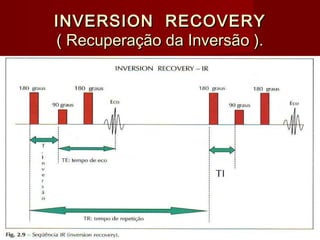 INVERSION RECOVERYINVERSION RECOVERY
( Recuperação da Inversão ).( Recuperação da Inversão ).
 