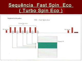 Sequência Fast Spin EcoSequência Fast Spin Eco
( Turbo Spin Eco )( Turbo Spin Eco )
 