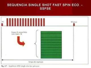 SEQUENCIA SINGLE SHOT FAST SPIN ECO -SEQUENCIA SINGLE SHOT FAST SPIN ECO -
SSFSESSFSE
 