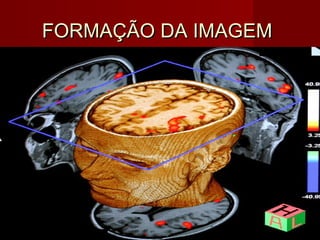 FORMAÇÃO DA IMAGEMFORMAÇÃO DA IMAGEM
 